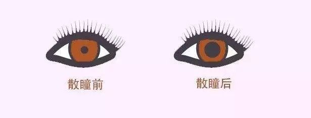 配眼鏡還散瞳，散瞳對(duì)眼睛有傷害嗎