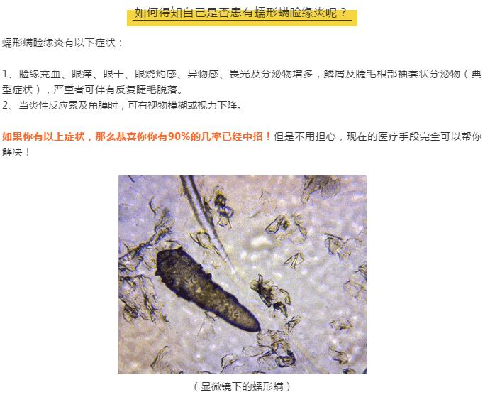 小心！你的眼睛可能正在被螨蟲肆虐